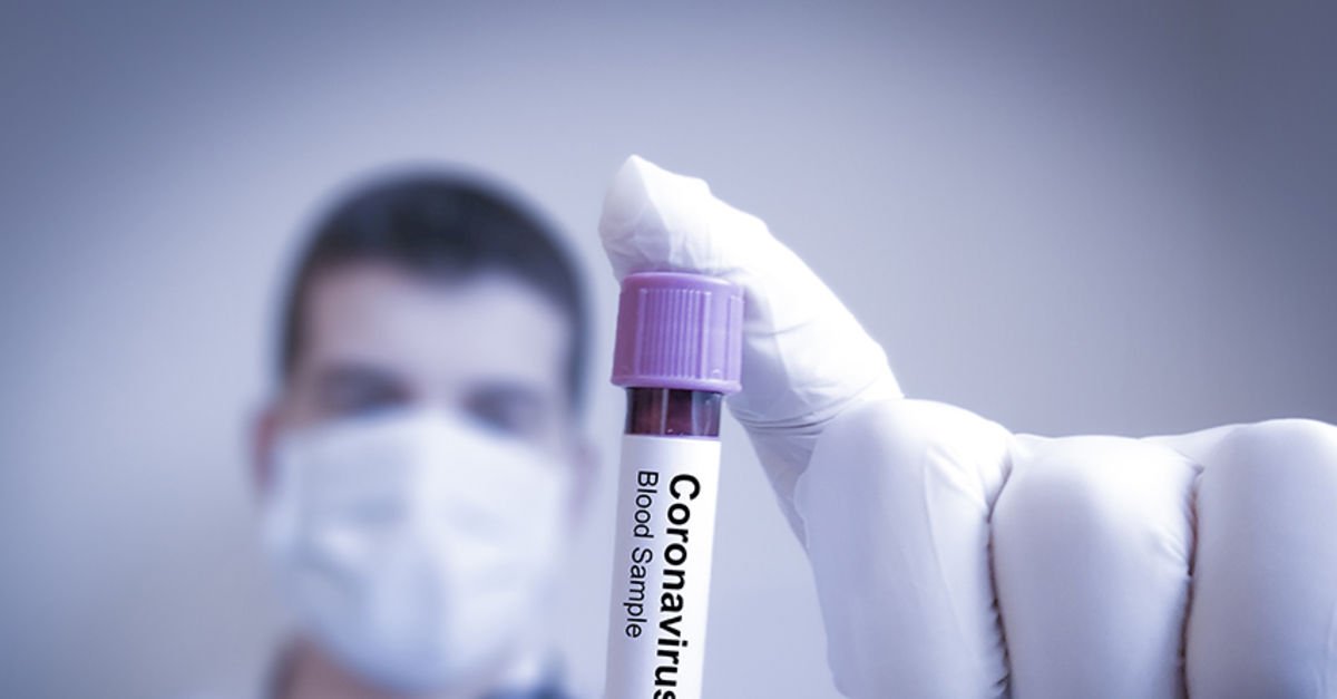 Koronavirüs salgınında yeni vaka sayısı 5 bin 575