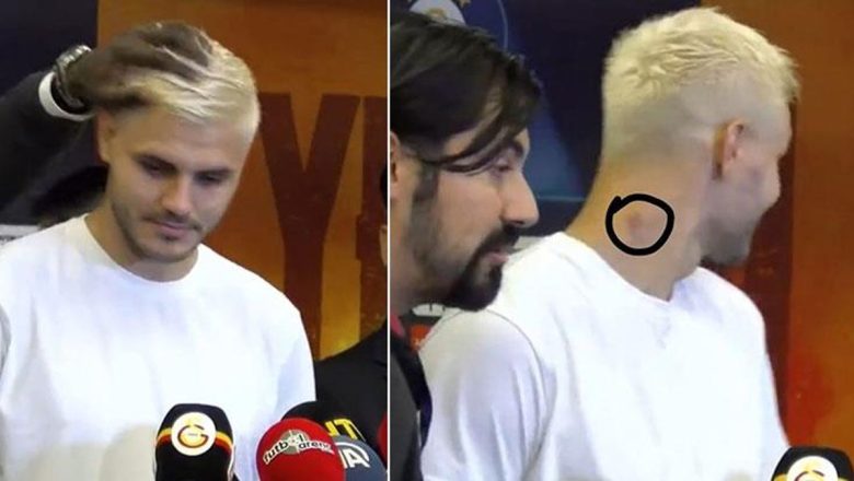  Galatasaraylı futbolcu Icardı’nin boynundaki morluk maç sonuna damga vurdu